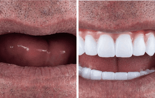 Quick, Cost-Effective, and Complete Restoration