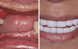 Quick, Cost-Effective, and Complete Restoration