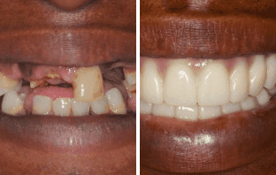 Quick, Cost-Effective, and Complete Restoration