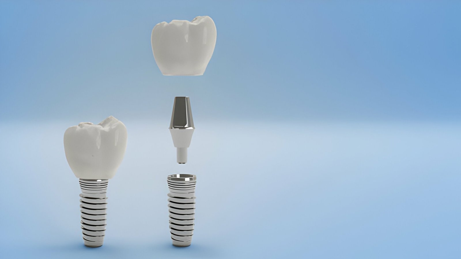 Dental Implants
