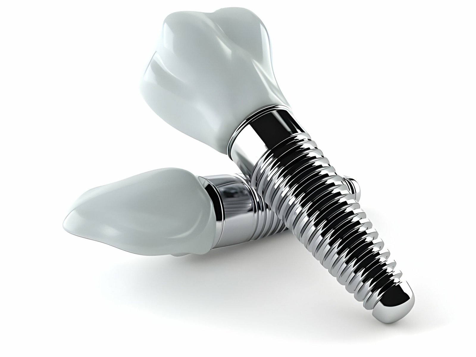 Dental Implants
