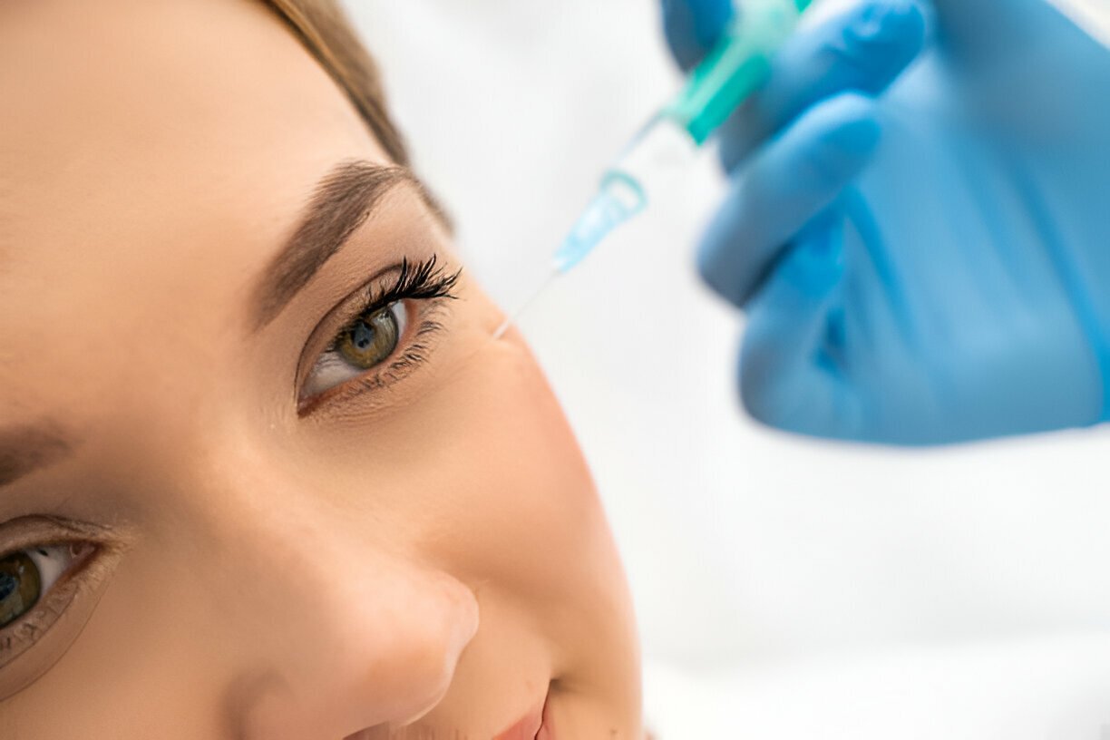 Botox Around Your Eyes