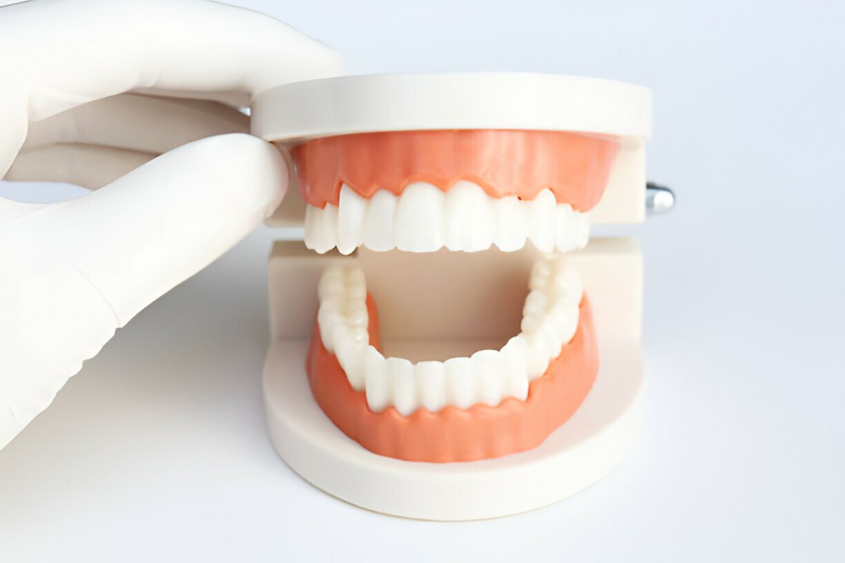 dentures