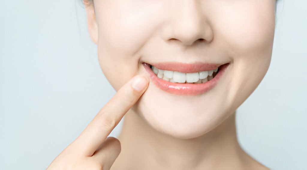 Dental Fillings