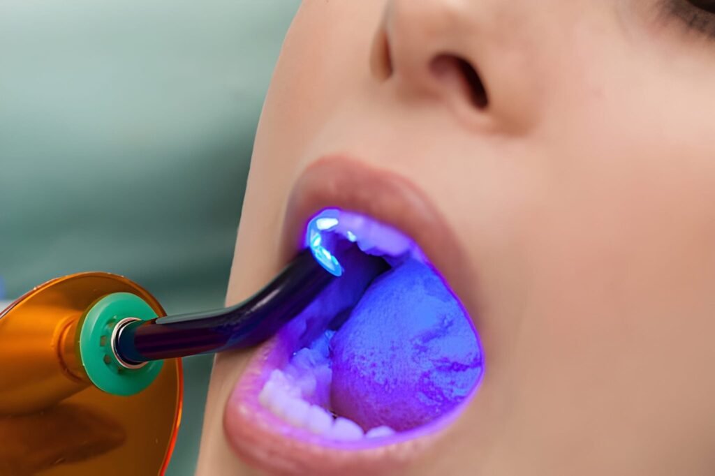 Composite Bonding
