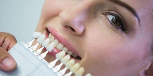 Composite Bonding