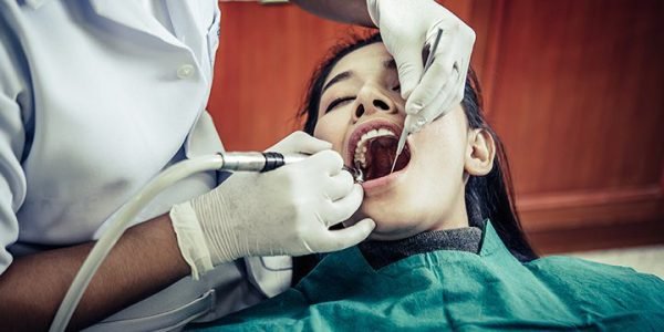 Tooth Extraction